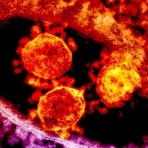 Infection Nosocomiale